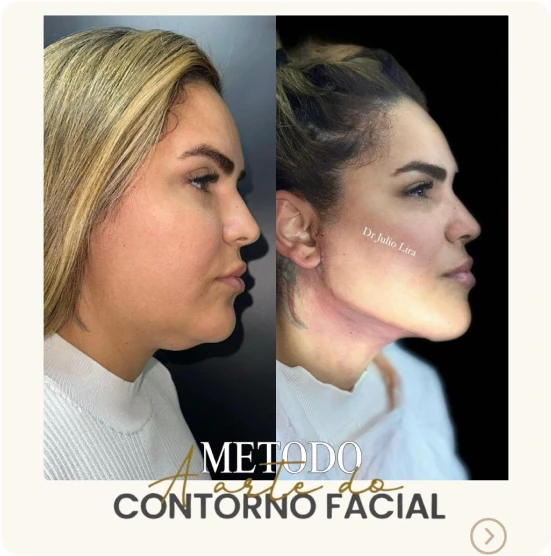 antes-depois-alunos-1