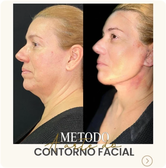 antes-depois-alunos-10