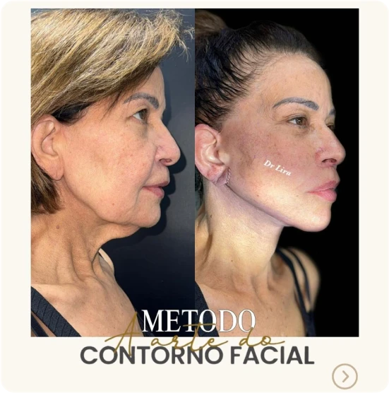 antes-depois-alunos-11