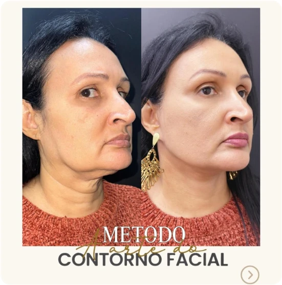 antes-depois-alunos-2