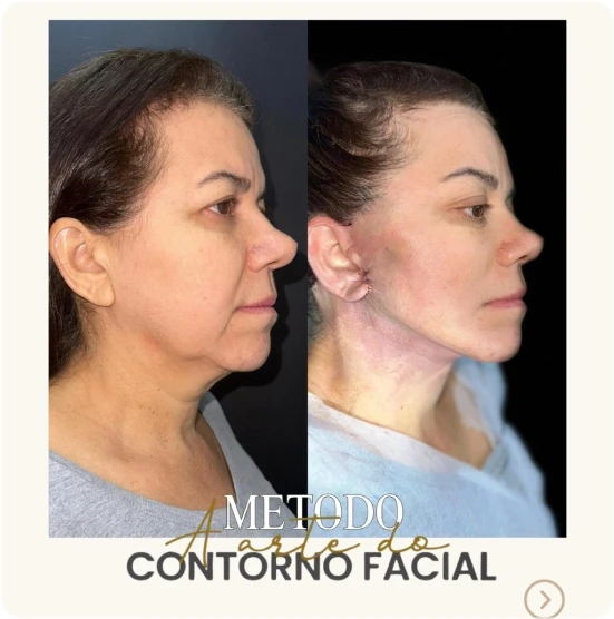 antes-depois-alunos-3