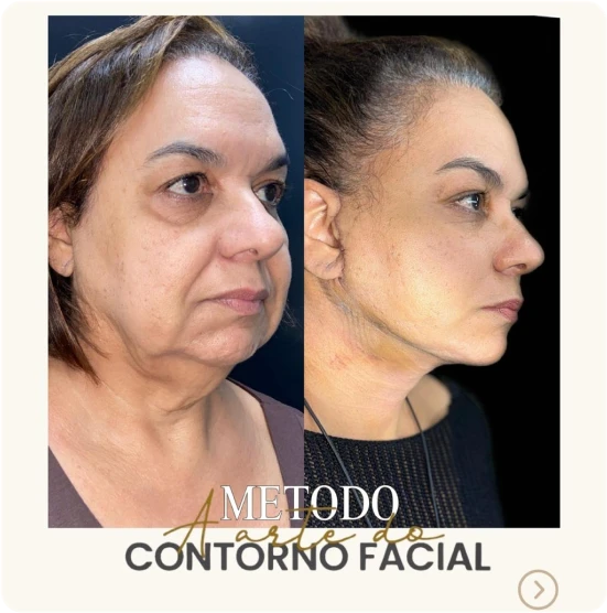 antes-depois-alunos-4