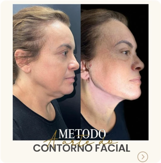 antes-depois-alunos-5