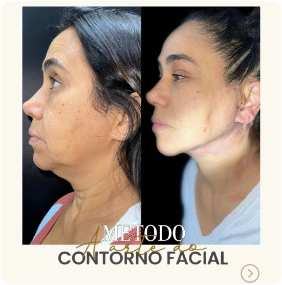 antes-depois-alunos-6