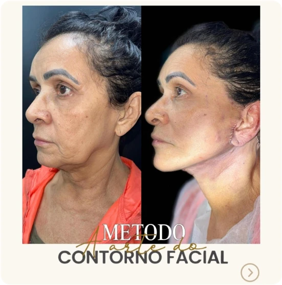antes-depois-alunos-7