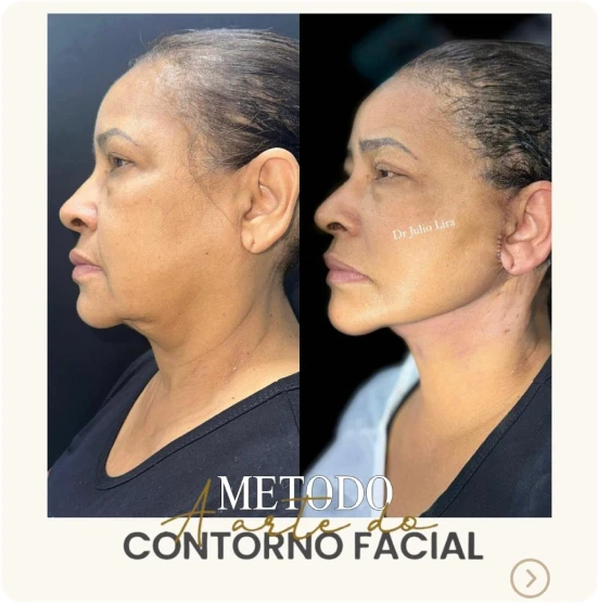 antes-depois-alunos-8
