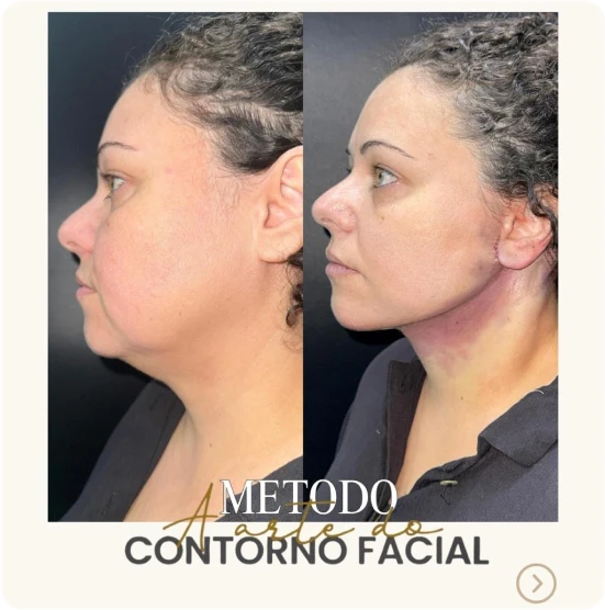 antes-depois-alunos-9