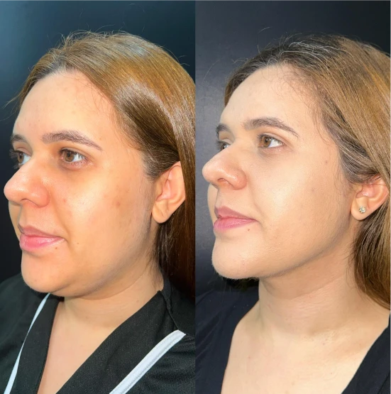 antes-depois-julio-12
