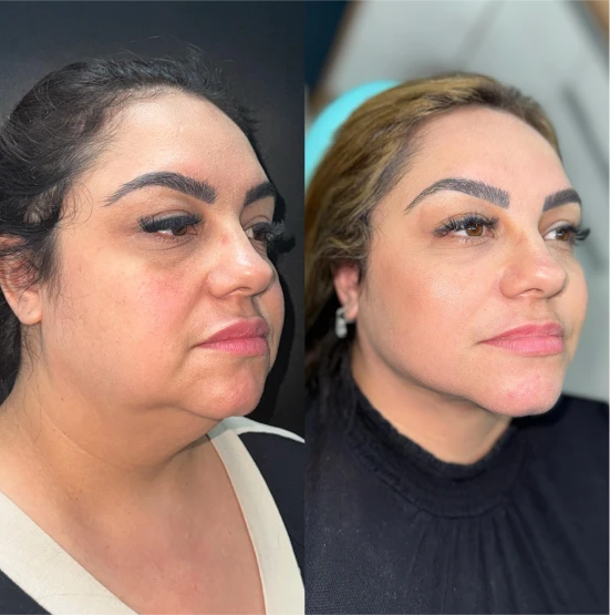 antes-depois-julio-13