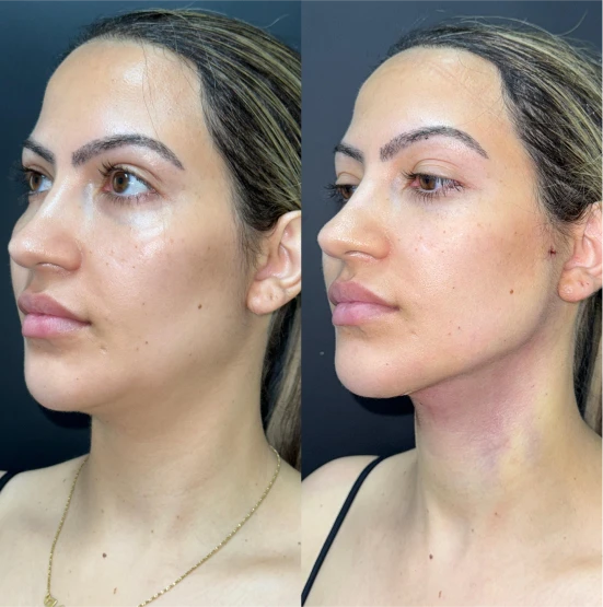 antes-depois-julio-14