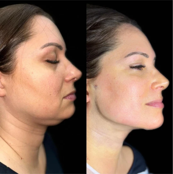 antes-depois-julio-15
