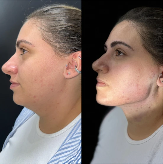 antes-depois-julio-2
