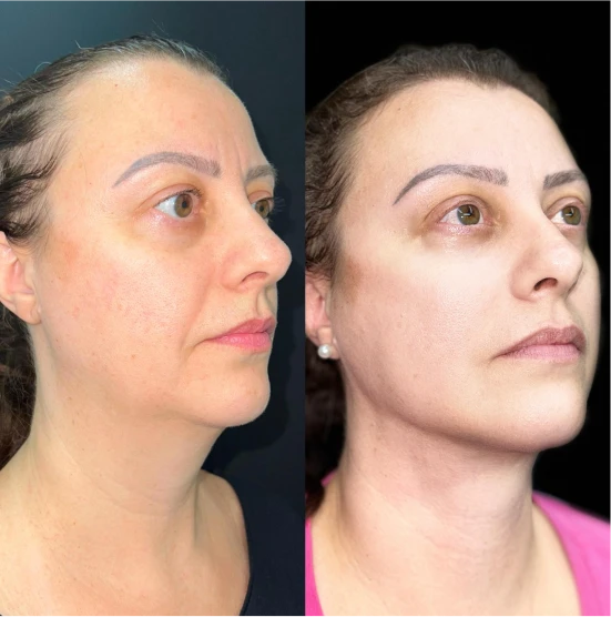 antes-depois-julio-3