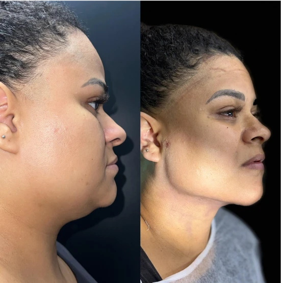antes-depois-julio-4