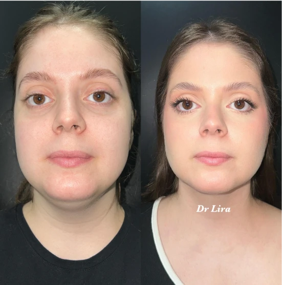 antes-depois-julio-5