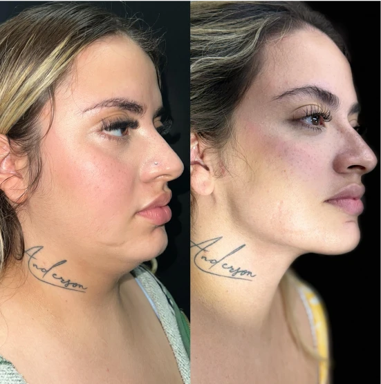 antes-depois-julio-6