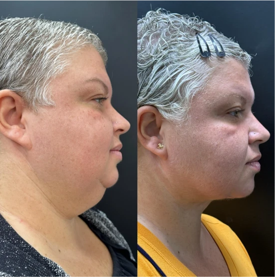 antes-depois-julio-7