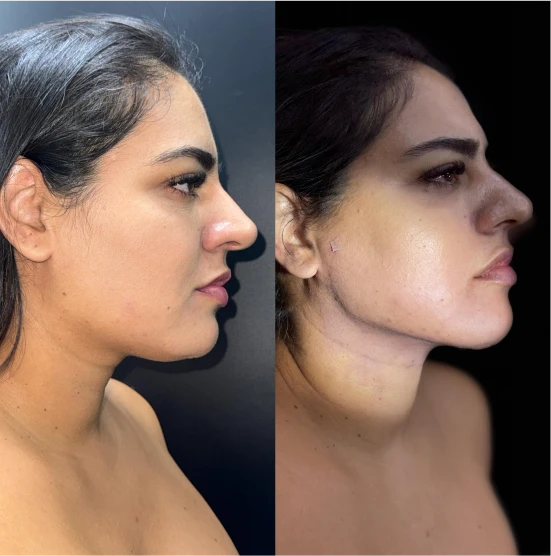 antes-depois-julio-8