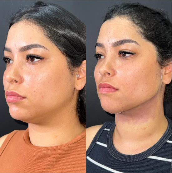 antes-depois-julio-9